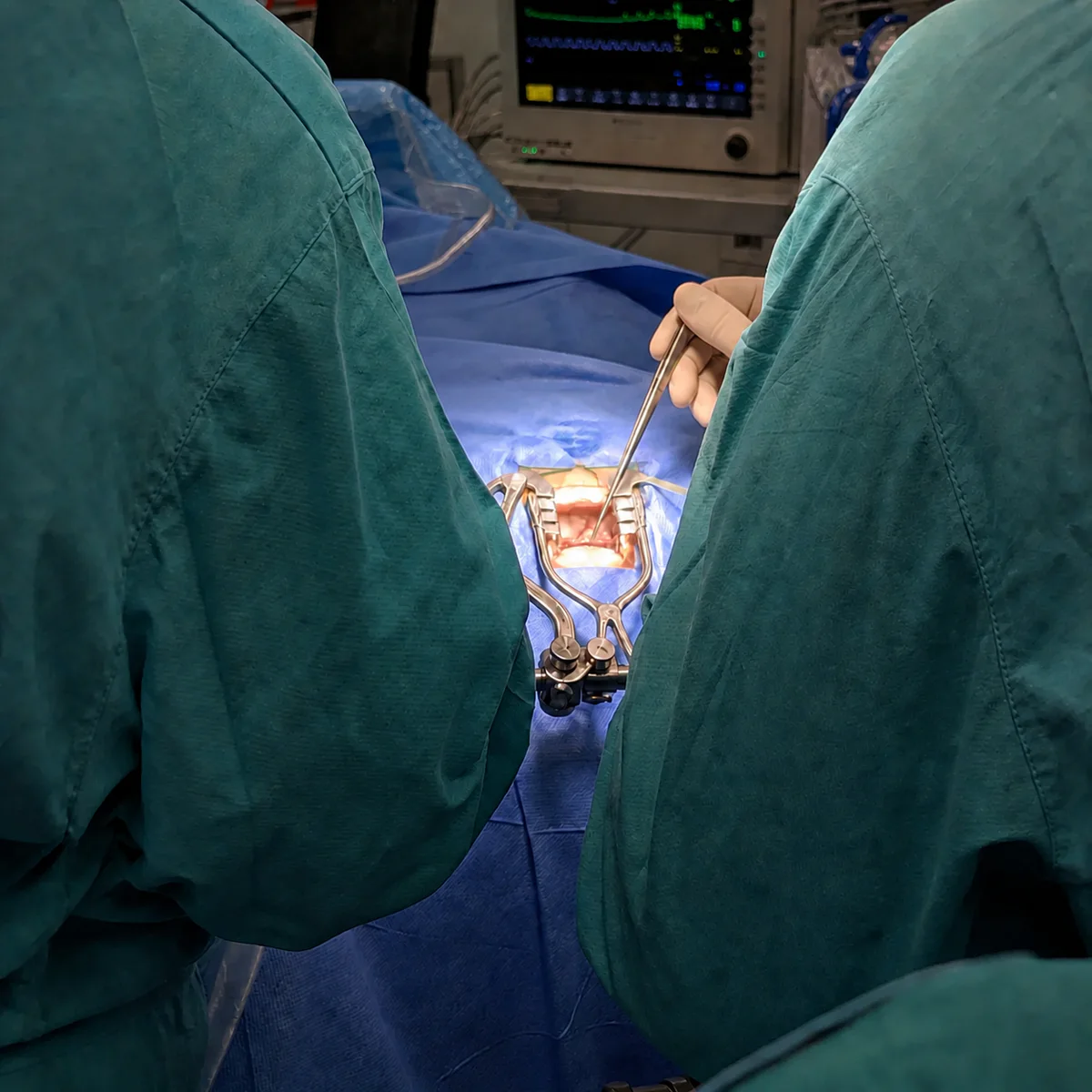Intervention neurochirurgicale en cours au bloc opératoire